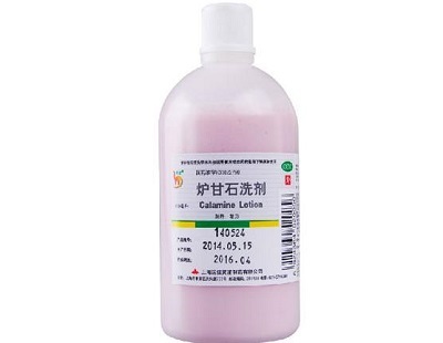 炉甘石洗剂能治疗哪些皮肤病