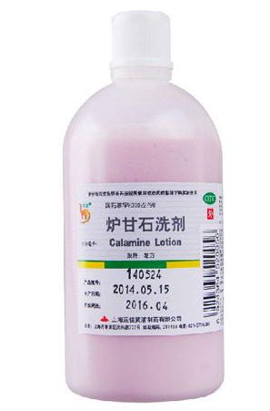 炉甘石洗剂怎么用 炉甘石洗剂用法详解