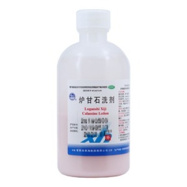 炉甘石洗剂治牛皮癣吗
