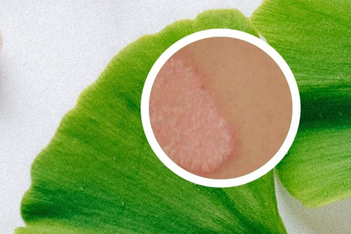 氢醌乳膏生产企业是什么