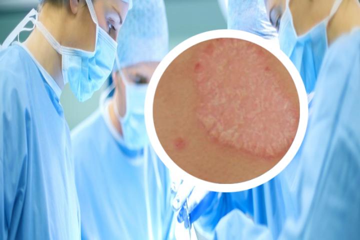 孕妇能不能使用他卡西醇软膏呢
