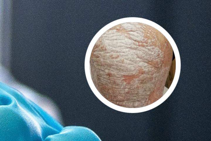 百花牌六味防脱生发酊的说明书是什么