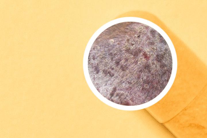 头上擦林旦乳膏会有副作用吗