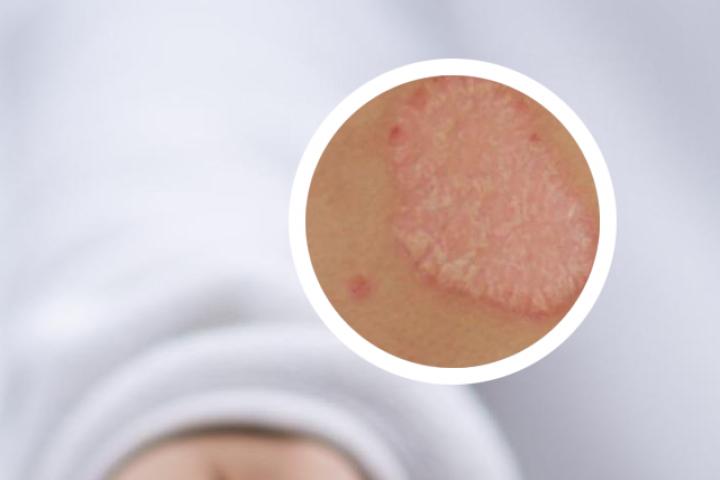 环孢素软胶囊的药理毒理是怎样呢